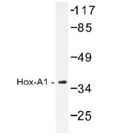 NB100-92347 - HOXA1 / HOX1F