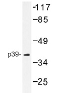 NB100-92371 - CDK5R2