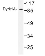 NB100-92377 - DYRK1A