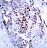 NB100-92482 - Bcl-2