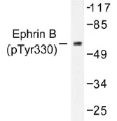 NB100-92527 - EPHB1