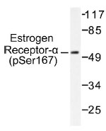 NB100-92531 - Estrogen receptor alpha