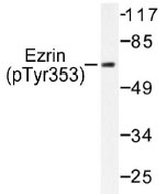 NB100-92532 - Ezrin