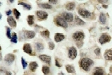 NB100-92546 - HDAC8