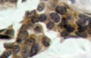 NB100-92563 - NFKBIA / IKBA