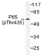 NB100-92597 - RELA / NF-kB p65