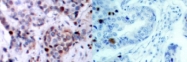 NB100-92597 - RELA / NF-kB p65