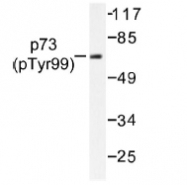 NB100-92609 - Tumor protein p73 (TP73)