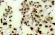 NB100-92609 - Tumor protein p73 (TP73)