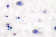 NB100-92656 - TrkB