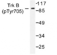 NB100-92657 - TrkB