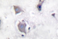 NB100-92657 - TrkB