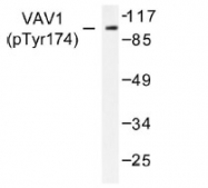 NB100-92660 - VAV1