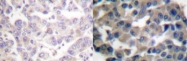 NB100-92660 - VAV1