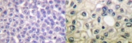 NB100-92699 - BCAR1 / CRKAS