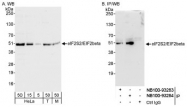 NB100-93284 - EIF2B / EIF2S2