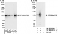 NB100-93302 - EIF3B / EIF3S9