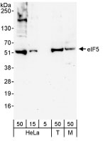 NB100-93312 - EIF5