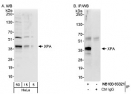 NB100-93321 - XPA / XPAC