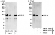 NB100-93325 - NUP98 / ADAR2