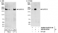 NB100-93336 - NUP210 / GP210