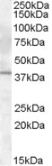 NB100-93409 - Interleukin-12 beta / IL12B