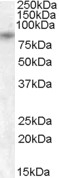 NB100-93520 - TRPV5 / ECAC1