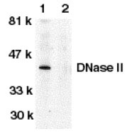 NB100-94212 - Deoxyribonuclease-2-alpha