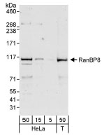 NB100-94994 - RanBP8 / Importin-8