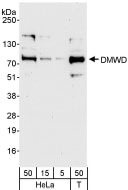 NB100-95001 - DMWD / DM9