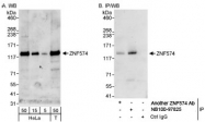 NB100-97825 - ZNF574