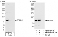 NB100-97850 - EPS8L2