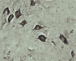 NB100-98931 - VPS45