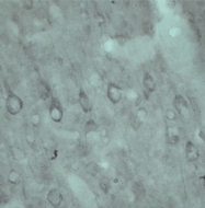 NB100-98931 - VPS45