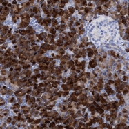 NBP1-87570 - LPPR1 / PRG3