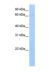 NBP1-69260 - Ribophorin-1 / RPN1