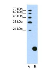 NBP1-57477 - RPS29