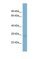 NBP1-59041 - UQCRFS1 (Complex III subunit Rieske)