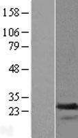 NBL1-16693 - transgelin 2 Lysate