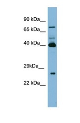 NBP1-57678 - Transglutaminase-3 (TGM3)