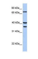 NBP1-54329 - Transglutaminase-5 (TGM5)