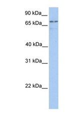 NBP1-54404 - Transglutaminase-7 (TGM7)