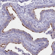 NBP1-92528 - TMEM138