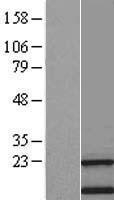 NBL1-17012 - transmembrane protein 138 Lysate