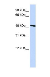NBP1-56652 - Tropomodulin-3 (TMOD3)
