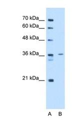 NBP1-57612 - Tropomyosin-2 (TPM2)