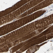 NBP1-87382 - Tropomyosin-3 (TPM3)