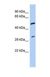 NBP1-57472 - Tropomyosin-3 (TPM3)