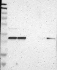 NBP1-87382 - Tropomyosin-3 (TPM3)