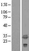 NBL1-17221 - tropomyosin-4 Lysate